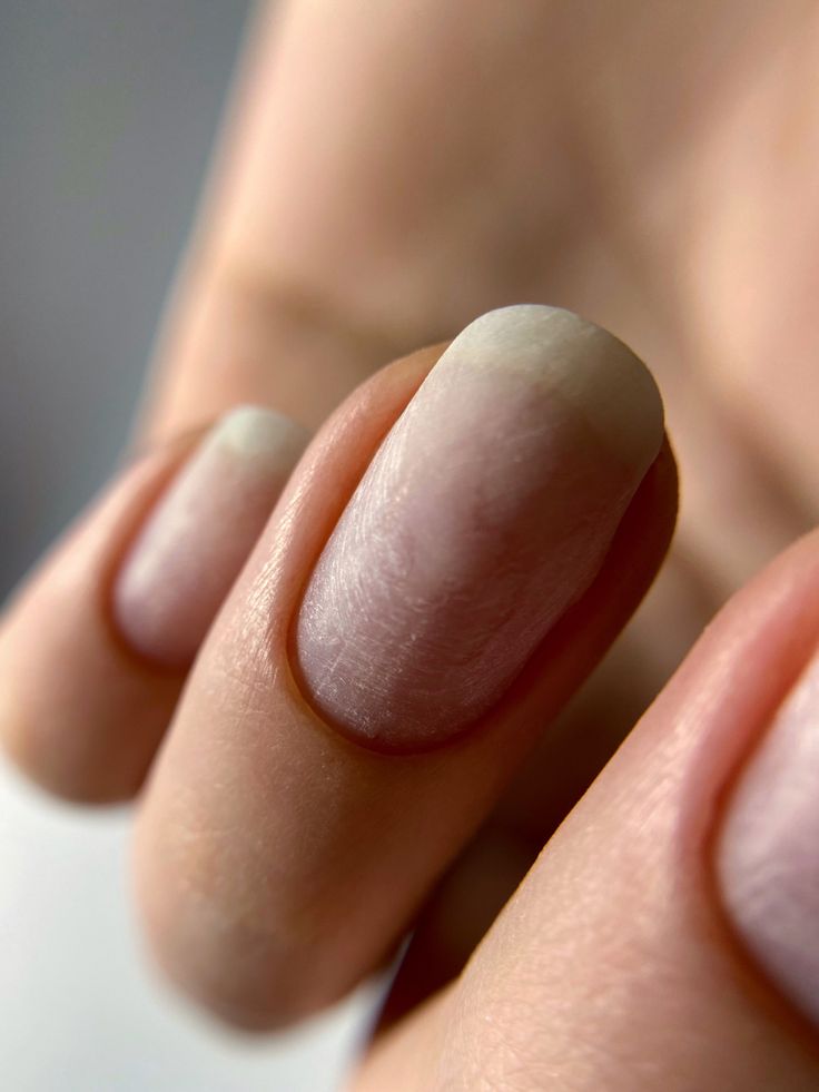 Ongles mous : pourquoi ?
